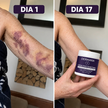 DERMARA® | ESTE VERANO, VOLVÉ A MOSTRAR TU PIEL CUIDADA