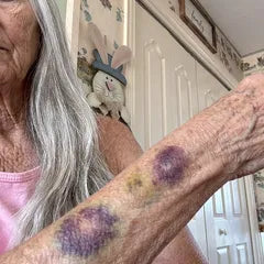 Mujer adulta cuidando la piel de sus brazos