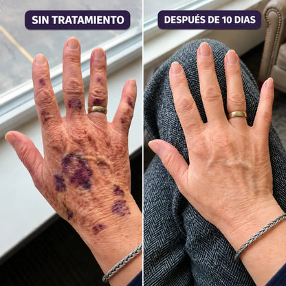 DERMARA® | ESTE VERANO, VOLVÉ A MOSTRAR TU PIEL CUIDADA